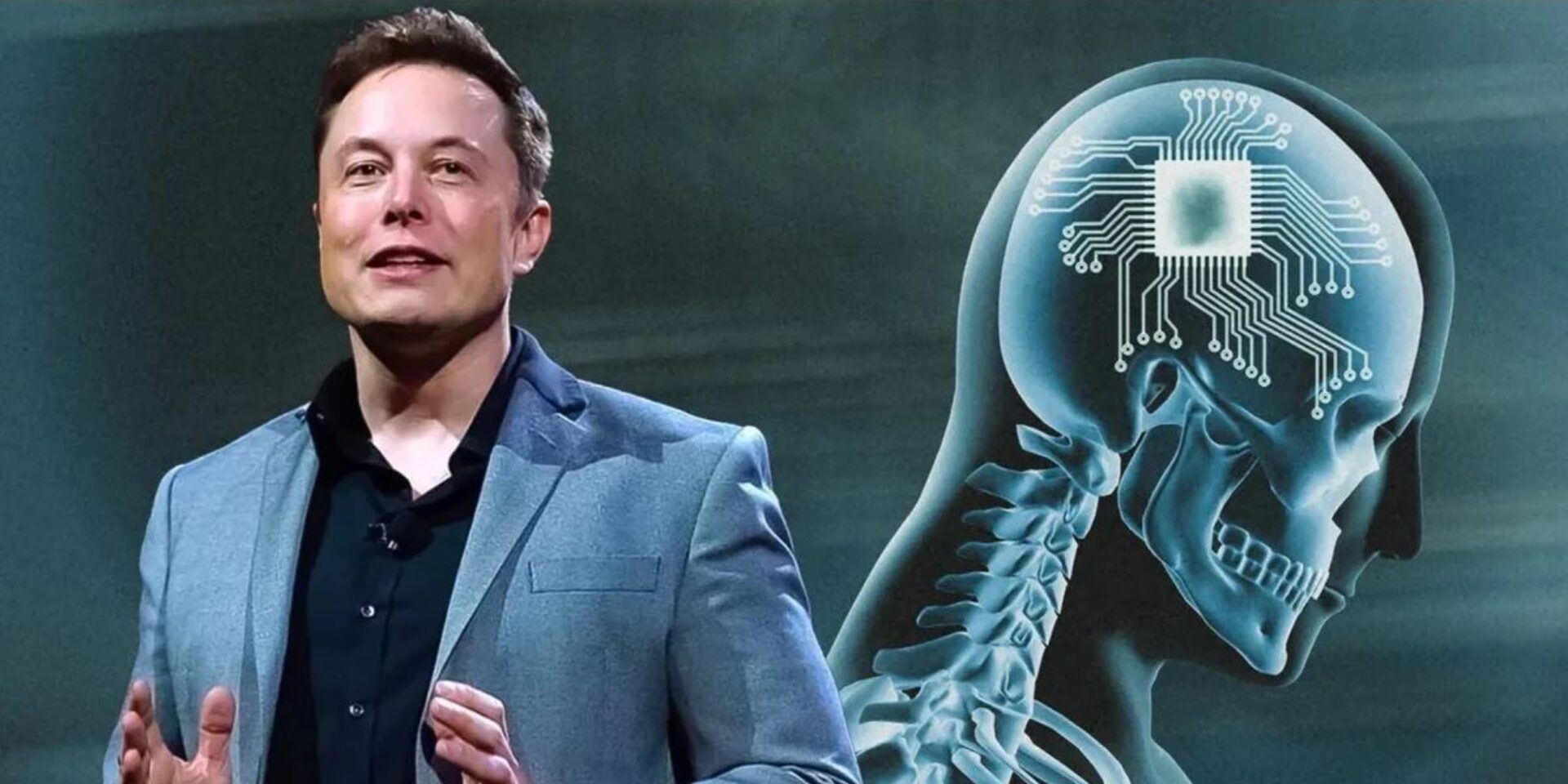 Empresa de Elon Musk foi autorizada a testar chips cerebrais em humanos￼
